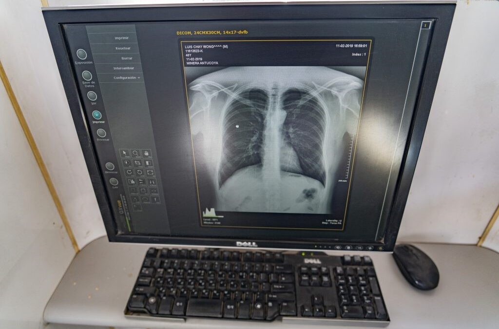 Más de 200 personas se realizaron exámenes radiológicos de tórax en faena